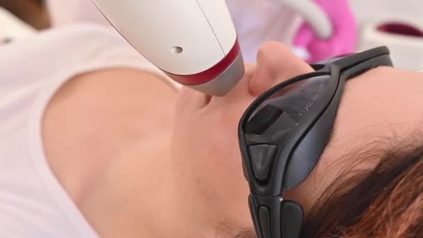 Close-up van laser ontharing op een vrouwengezicht. De arts verwijdert ongewenst haar van de patiënt boven de lip met een elektrisch apparaat — Stockvideo