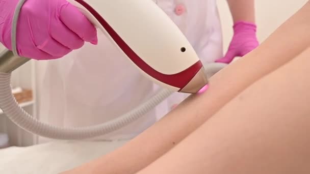 Close-up de depilação a laser na perna. O médico remove o cabelo indesejado do paciente com um dispositivo elétrico — Vídeo de Stock