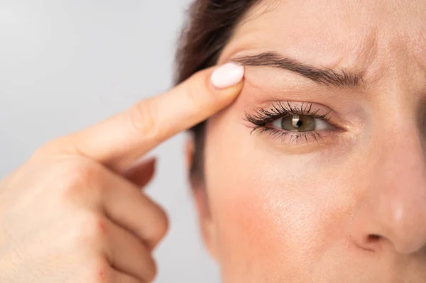 Retrato de cerca de una mujer caucásica de mediana edad que señala las arrugas del párpado superior. Signos de envejecimiento en la cara — Foto de Stock