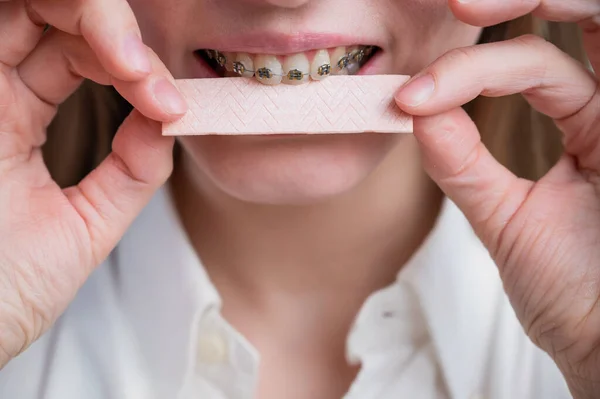Mujer joven con frenos de metal en los dientes es goma de mascar. La chica está comiendo caramelos de goma —  Fotos de Stock