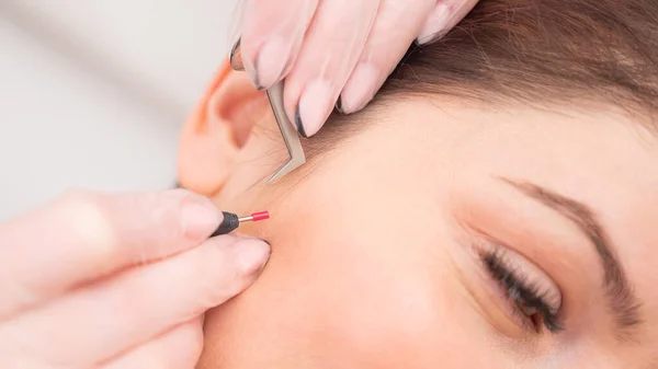 Mujer en electroepiléptica de la cara. Hardware eliminación permanente de cabello no deseado en el salón — Foto de Stock