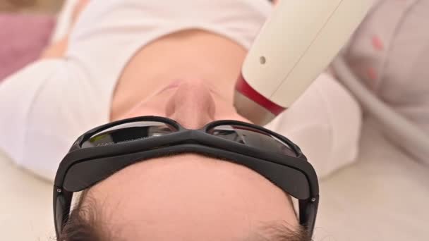 Крупним планом лазерне видалення волосся на обличчі жінок. Лікар видаляє небажані волосся з пацієнта над губою за допомогою електричного пристрою — стокове відео