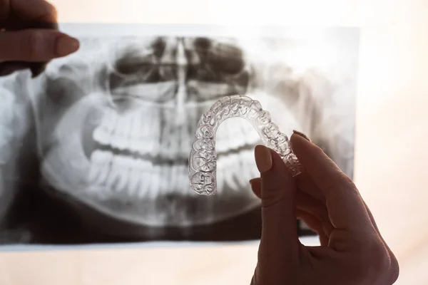 Manos femeninas con protectores bucales transparentes para corregir la mordida y la radiografía de la mandíbula. El ortodoncista sostiene el equipo del ortodoncista — Foto de Stock