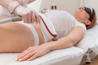 Lazer epilasyon prosedürü uygulayan bir kadın. İstenmeyen bitki örtüsünün donanımla kaldırılması