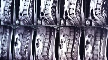 Belkemiğinin manyetik rezonans görüntülemesi.