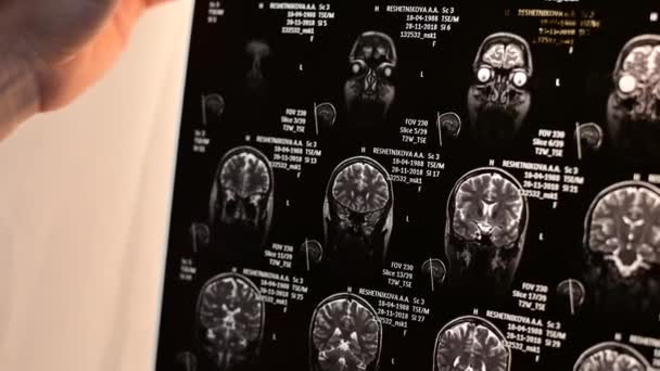 Magnetic resonance imaging of the human brain. — Stock Video