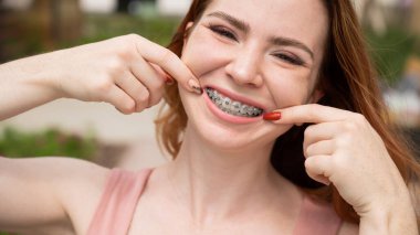 Dişlerinde diş teli olan genç kızıl saçlı kadın yazın açık havada gülümsediğini gösteriyor.