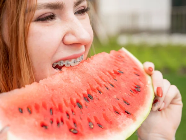 Close-up portrait of red-haired young woman with braces eating watermelon outdoors — Stock Photo, Image