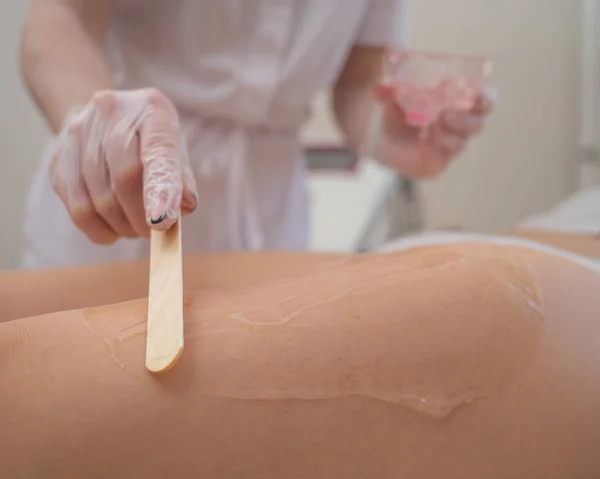 El maestro aplica el gel anestésico con una espátula a las piernas de las mujeres antes de la depilación láser. Depilación permanente con un dispositivo en la clínica — Foto de Stock