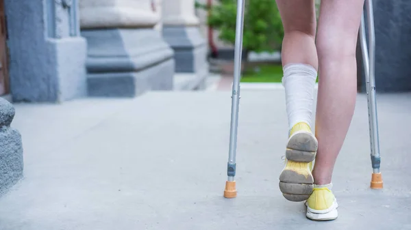 Close-up of female legs with ankle injury and crutches — Stock Photo, Image