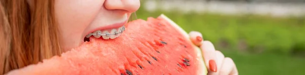 Close-up portrait of red-haired young woman with braces eating watermelon outdoors — Stock Photo, Image