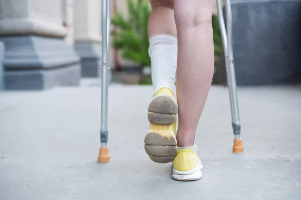 Close-up of female legs with ankle injury and crutches — Stock Photo, Image