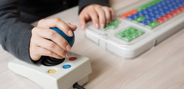 Una mujer irreconocible con parálisis cerebral está escribiendo en el teclado. Una chica con discapacidad trabaja en una computadora especialmente equipada — Foto de Stock