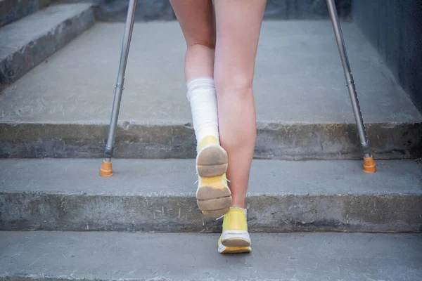 Mladá žena s poraněním kotníku stoupá po schodech na berlích. — Stock fotografie