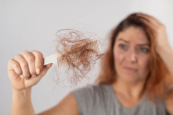 Mujer caucásica con una mueca de horror sostiene un peine con un moño de pelo. Pérdida de cabello y alopecia femenina. — Foto de Stock