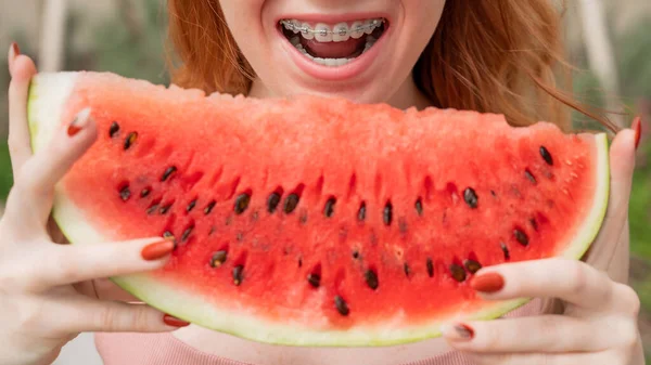 Beautiful red-haired woman smiling with braces and about to eat a slice of watermelon outdoors in summer — Stock Photo, Image