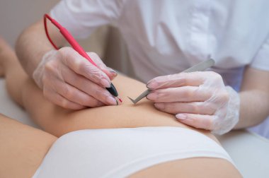 Doktor bikini bölgesinin elektro epilasyonunu kuaförde bir kadına yapıyor. İstenmeyen vücut kıllarını kalıcı olarak almanın başka bir yolu.