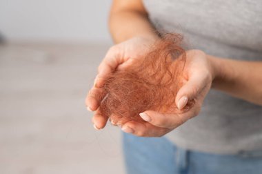 Kızıl saçlı bir bayanın el ele tutuşması. Saç kaybı ve kadın kelliği.