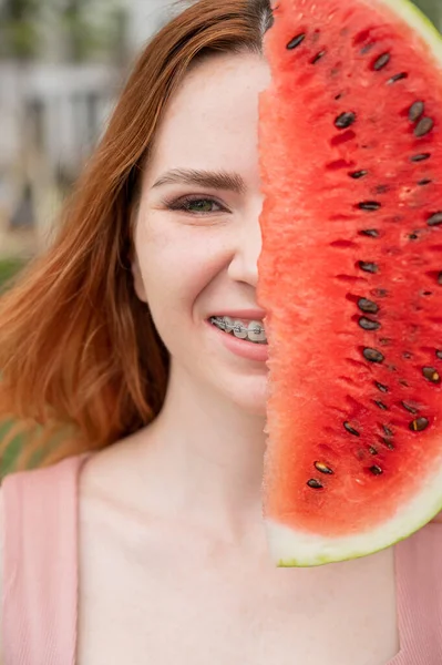 Beautiful red-haired woman smiling with braces on her teeth covers half of her face with a slice of watermelon outdoors in summer — Stock Photo, Image