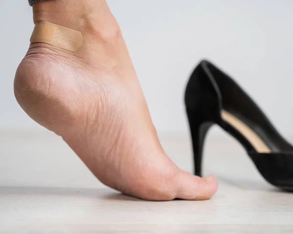 Une femme en chaussures noires met un plâtre sur un maïs — Photo