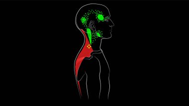 Trigger points and reflected pain in the trapezius. Anatomy. Illustration on black background. clipart