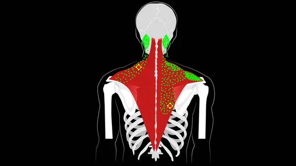 Триггер указывает и отражает боль в трапеции. Анатомия. — стоковое фото