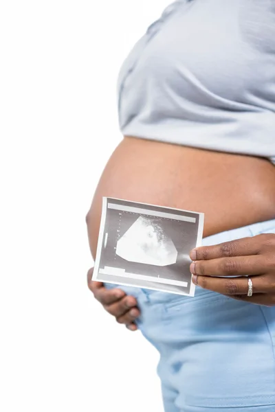 Terhes nő gazdaság ultrahang — Stock Fotó