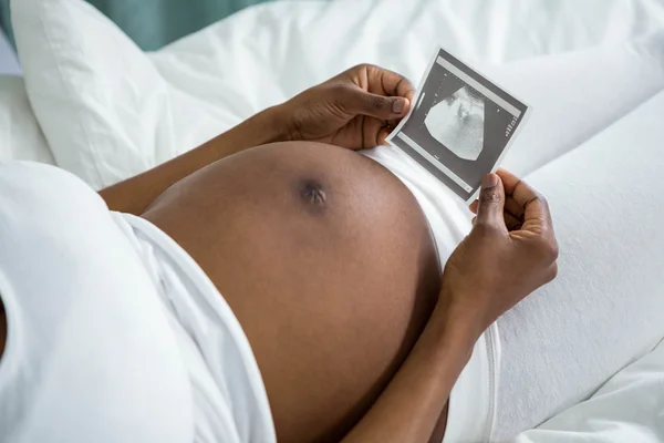 怀孕的女人望着超声图片 — 图库照片