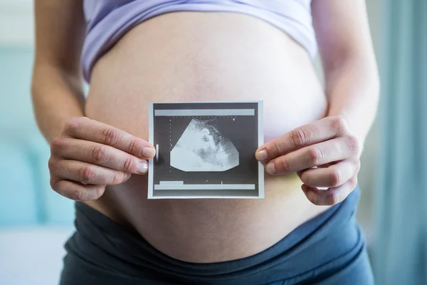 Mulher grávida segurando um ultra-som — Fotografia de Stock