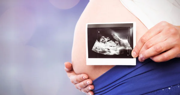 Mujer embarazada mostrando ecografías — Foto de Stock