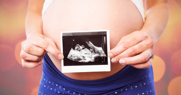 Femme enceinte montrant des échographies — Photo