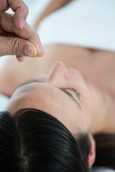 Pregnant woman in an acupuncture therapy — Stock Photo, Image