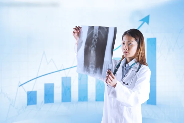 Asian doctor checking mri scan — Stock Photo, Image