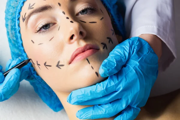 Patient avec des lignes pointillées sur le visage — Photo