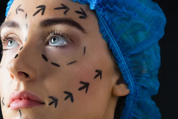 Patient with dotted lines on face — Stock Photo, Image