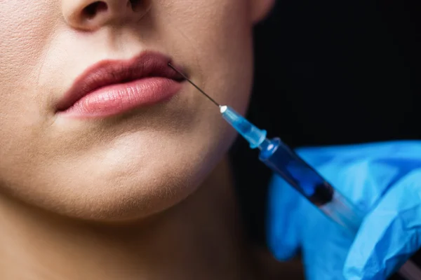 Woman receiving botox injection on lips — Stock Photo, Image