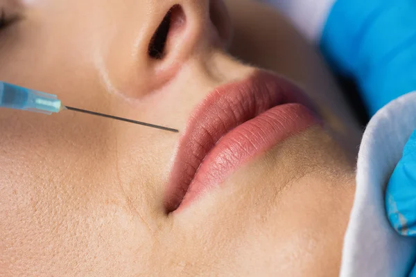 Woman receiving botox injection on lips — Stock Photo, Image