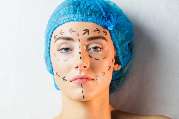 Patient with dotted lines on face — Stock Photo, Image