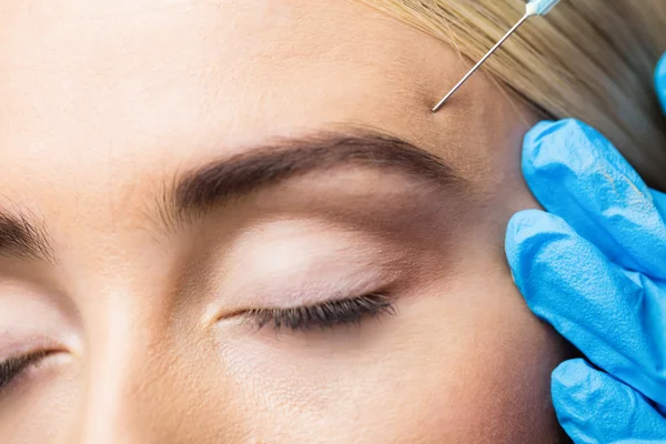 Woman receiving botox injection on forehead — Stock Photo, Image