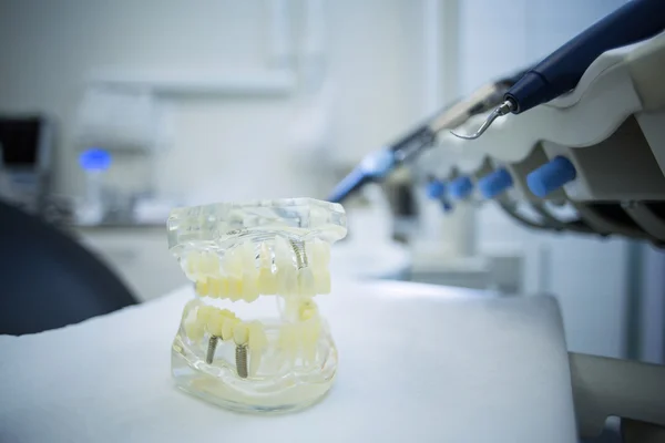 Ferramentas dentárias e dente artificial na bandeja — Fotografia de Stock