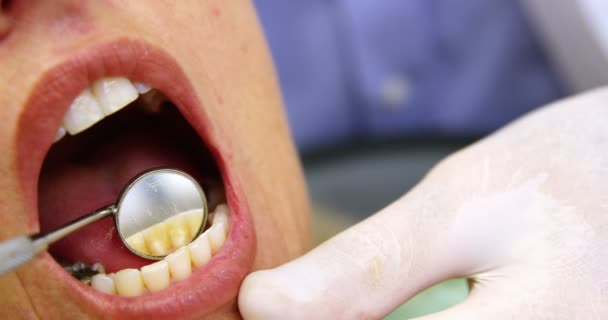 Bir kadın inceleyerek diş hekimi — Stok video