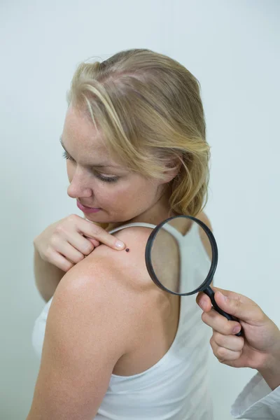 Dermatologist examining mole with magnifying glass — Stock Photo, Image