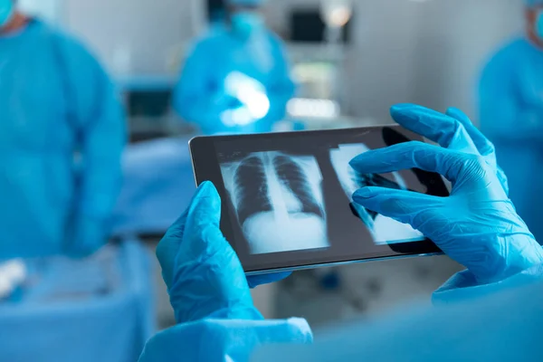 Médico Usando Luvas Cirúrgicas Olhando Para Radiografia Pulmonar Comprimido Medicina — Fotografia de Stock