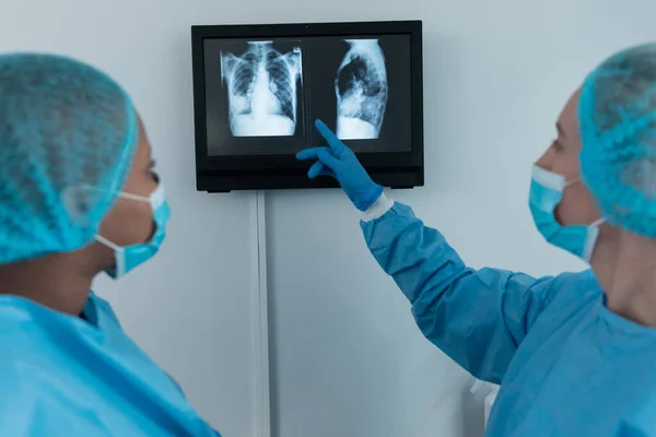 Diverse Vrouwelijke Chirurgen Operatiekamer Dragen Gezichtsmaskers Die Naar Het Scherm — Stockfoto