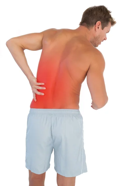 Людина з короткими шортами, що страждають від болю в спині — стокове фото