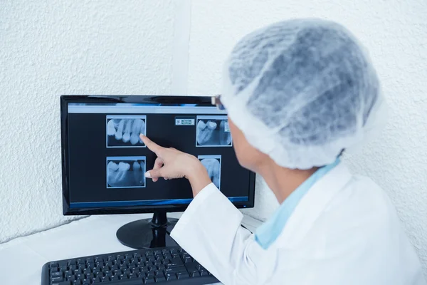 Dentista guardando i raggi X sul computer — Foto Stock