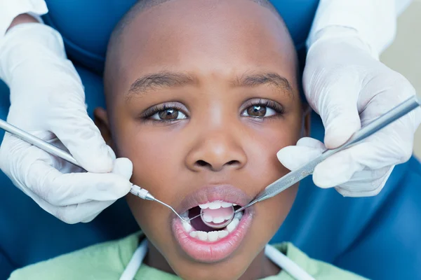 Gros plan d'un garçon qui se fait examiner les dents — Photo