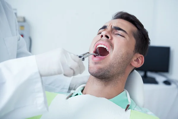 Bliska człowieka o jego zęby badane — Zdjęcie stockowe