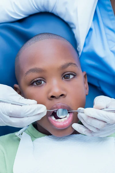 Menino com os dentes examinados pelo dentista — Fotografia de Stock