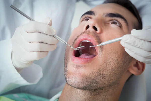 Hombre que tiene sus dientes examinados —  Fotos de Stock